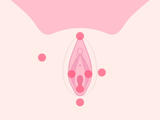 Area of vulva pain