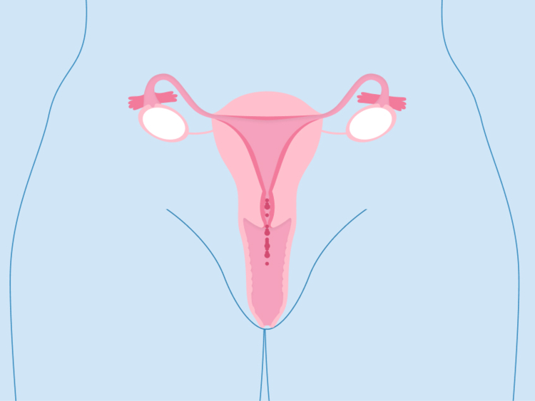 Cervical cancer stages: Signs, treatments, and prevention 