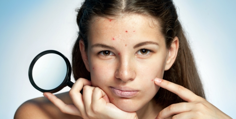 Spots, Dry, and Oily Skin: How Hormones Affect Your Skin Before and During a Period