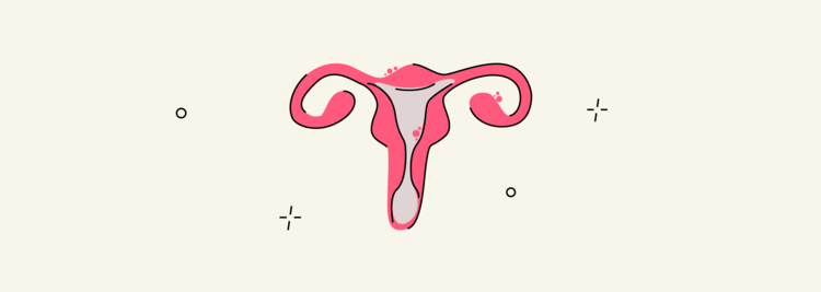 Endometriosis and Infertility: Can Endometriosis Cause Infertility and What to Do About It?