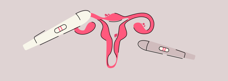 Beautiful view of How To Get Pregnant With Endometriosis